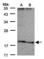 SCN3B Antibody in Western Blot (WB)