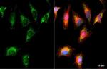 BCKDK Antibody in Immunocytochemistry (ICC/IF)