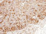 BCKDK Antibody in Immunohistochemistry (Paraffin) (IHC (P))