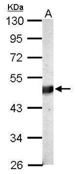 BCKDK Antibody in Western Blot (WB)