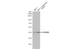 BCKDK Antibody in Western Blot (WB)