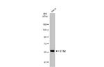 ETS2 Antibody in Western Blot (WB)