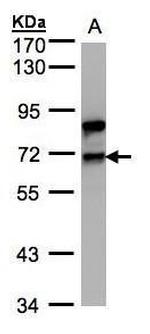 SF1 Antibody in Western Blot (WB)