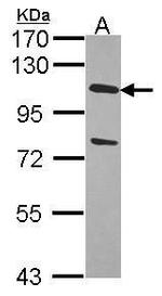 USP28 Antibody in Western Blot (WB)