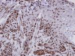 FCP1 Antibody in Immunohistochemistry (Paraffin) (IHC (P))