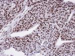 FCP1 Antibody in Immunohistochemistry (Paraffin) (IHC (P))