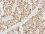 PSMB5 Antibody in Immunohistochemistry (Paraffin) (IHC (P))