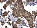 Stathmin 1 Antibody in Immunohistochemistry (Paraffin) (IHC (P))