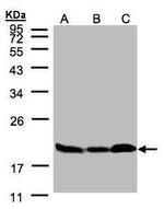 Stathmin 1 Antibody in Western Blot (WB)