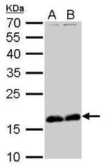 Stathmin 1 Antibody in Western Blot (WB)