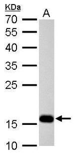 Stathmin 1 Antibody in Western Blot (WB)