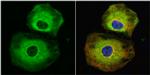 Stathmin 1 Antibody in Immunocytochemistry (ICC/IF)