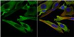 Stathmin 1 Antibody in Immunocytochemistry (ICC/IF)