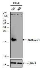 Stathmin 1 Antibody