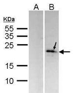 DUSP14 Antibody in Western Blot (WB)