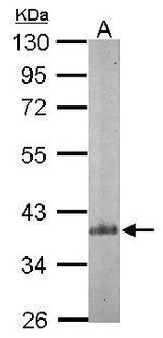 p41-ARCb Antibody in Western Blot (WB)