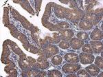 VDAC2 Antibody in Immunohistochemistry (Paraffin) (IHC (P))