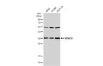 VDAC2 Antibody in Western Blot (WB)