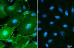 PD-L1 Antibody in Immunocytochemistry (ICC/IF)