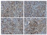 PD-L1 Antibody in Immunohistochemistry (Paraffin) (IHC (P))