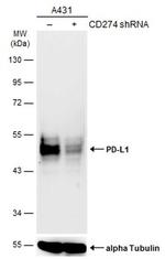 PD-L1 Antibody