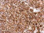 SIPA1 Antibody in Immunohistochemistry (Paraffin) (IHC (P))