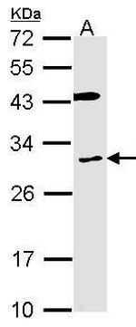 CYBRD1 Antibody in Western Blot (WB)