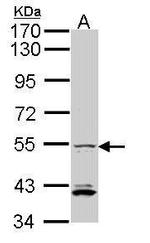 IRF5 Antibody in Western Blot (WB)