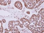 ZNF148 Antibody in Immunohistochemistry (Paraffin) (IHC (P))