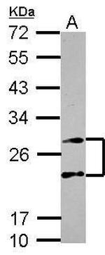 PSMA4 Antibody in Western Blot (WB)