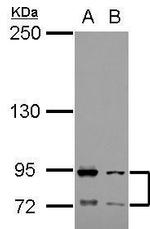 FCAR Antibody in Western Blot (WB)