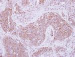 ADAM10 Antibody in Immunohistochemistry (Paraffin) (IHC (P))