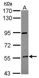 CYP4F12 Antibody in Western Blot (WB)