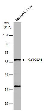 CYP26A1 Antibody in Western Blot (WB)