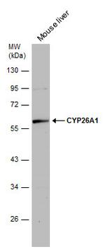 CYP26A1 Antibody in Western Blot (WB)