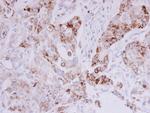 MTHFD2 Antibody in Immunohistochemistry (Paraffin) (IHC (P))