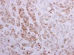 MTHFD2 Antibody in Immunohistochemistry (Paraffin) (IHC (P))