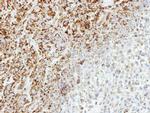 MTHFD2 Antibody in Immunohistochemistry (Paraffin) (IHC (P))