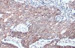 MTHFD2 Antibody in Immunohistochemistry (Paraffin) (IHC (P))