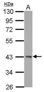 GALK1 Antibody in Western Blot (WB)