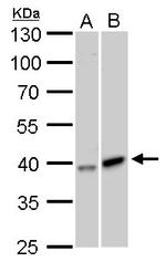 GALK1 Antibody in Western Blot (WB)