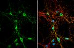 alpha Dystroglycan Antibody in Immunocytochemistry (ICC/IF)