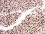 MAD1 Antibody in Immunohistochemistry (Paraffin) (IHC (P))