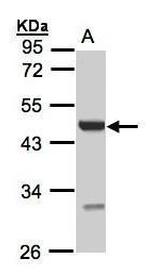 UST Antibody in Western Blot (WB)