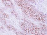 KIR2DL4 Antibody in Immunohistochemistry (Paraffin) (IHC (P))