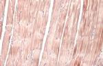 OGDH Antibody in Immunohistochemistry (Paraffin) (IHC (P))