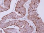 OTC Antibody in Immunohistochemistry (Paraffin) (IHC (P))