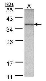 OTC Antibody in Western Blot (WB)