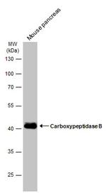 Carboxypeptidase B1 Antibody in Western Blot (WB)