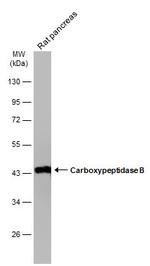 Carboxypeptidase B1 Antibody in Western Blot (WB)